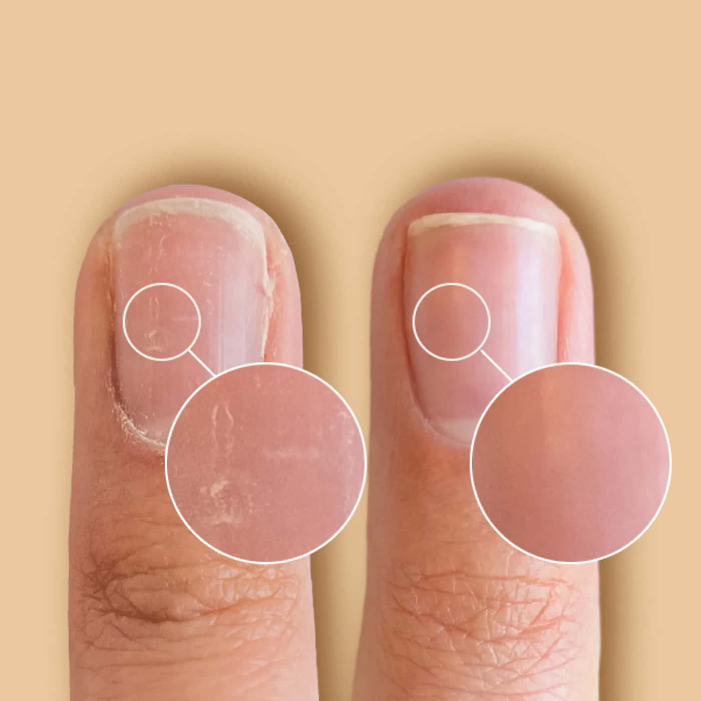 CND SolarOil 118 ml nail oil - fruity scent - hydrates and strengthens nails and cuticles - ideal for salon use