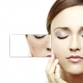 Biodroga MD Anti-Redness Rosa-Calming Serum Biodroga MD Anti-Redness Rosa-Calming Serum