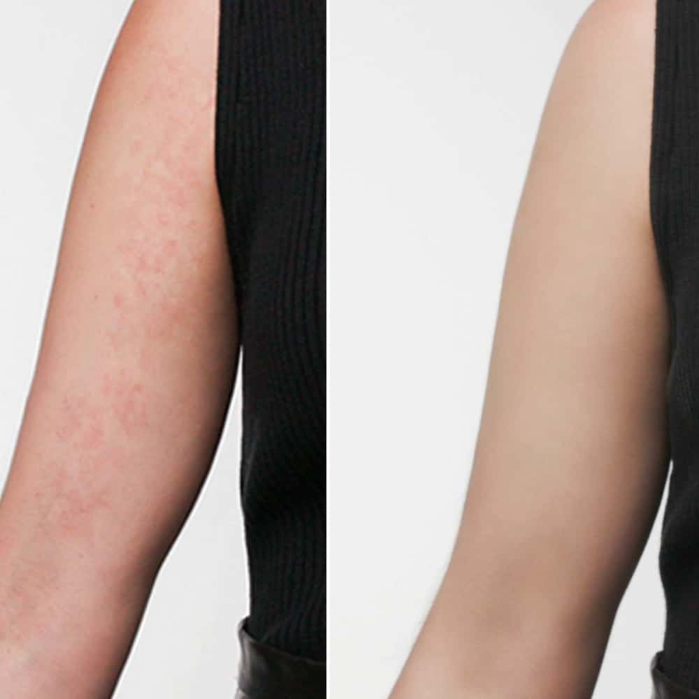 Artdeco Camouflage Cream